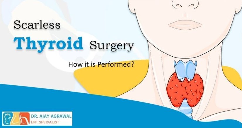 "Dr. Ajay Agrawal, ENT Specialist, performing advanced scarless thyroid surgery with innovative techniques."