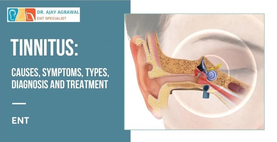 "Dr. Ajay Agrawal, ENT Specialist, providing comprehensive tinnitus evaluation and treatment options for ringing in ears."