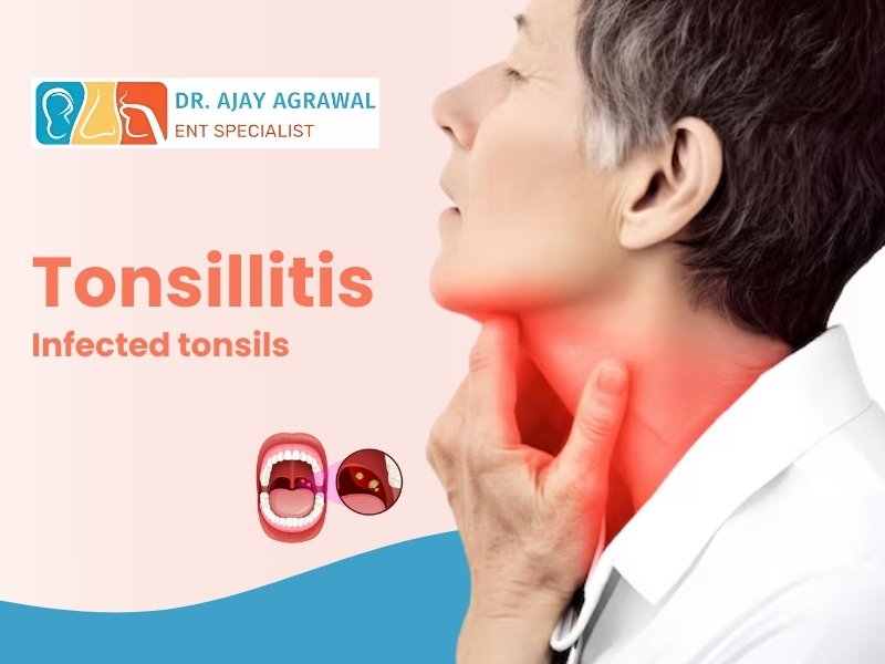 "Dr. Ajay Agrawal, ENT Specialist, treating tonsillitis and infected tonsils with professional medical care."